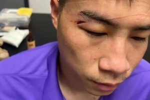 津媒：王獻(xiàn)鈞兩顆門(mén)牙被撞斷，楊帆眉骨受傷賽后去醫(yī)院縫針