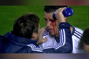 硬漢！C羅眉骨破裂現(xiàn)場縫針，單眼進(jìn)球霸氣回?fù)魧κ郑? >
                                        </div>
                                    </div>
                                                                        <div   id=