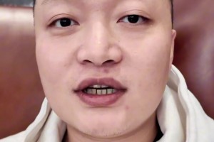 文班18歲的弟弟奧斯卡正效力于法國聯(lián)賽，跟哥哥比起來很普通